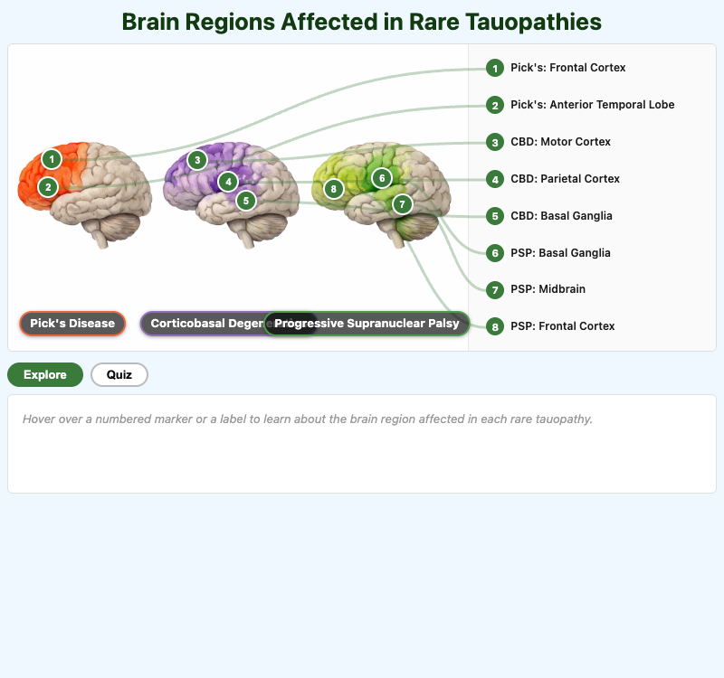 Brain Regions Affected in Rare Tauopathies